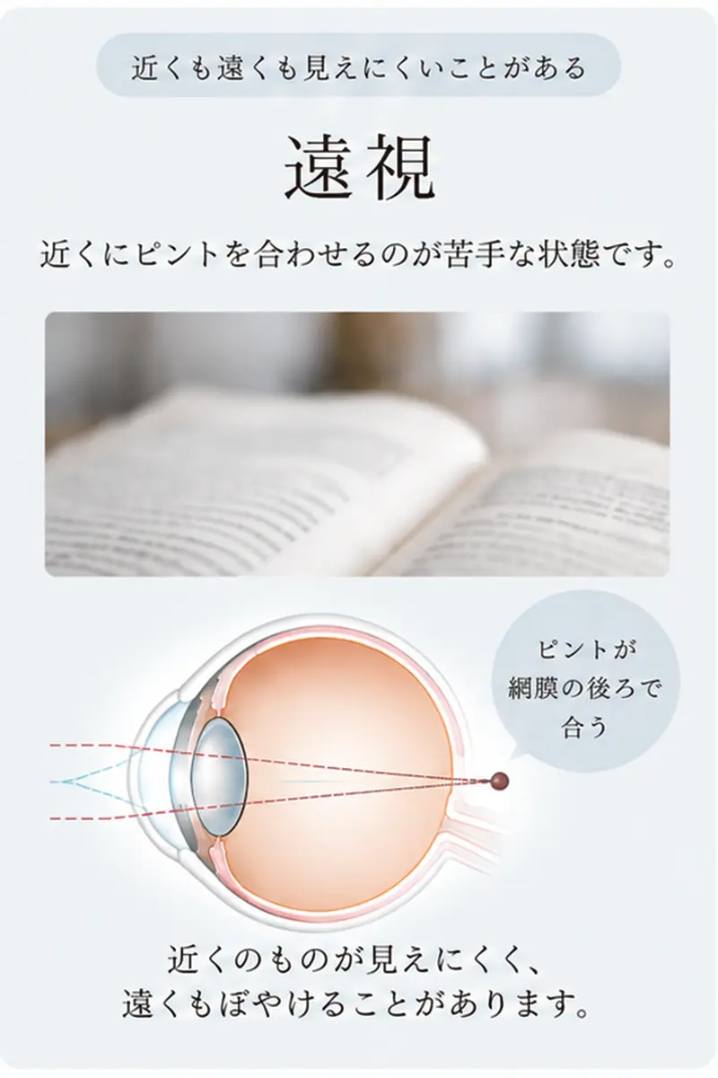 遠視は近くも遠くも見えにくいことがあり、ピントが網膜の後ろで合う状態