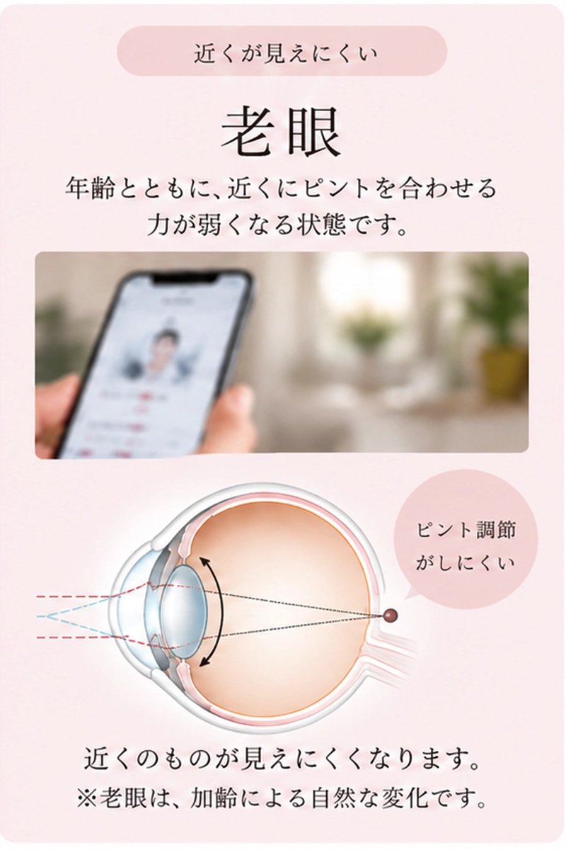 老眼は加齢でピント調節がしにくくなり、近くが見えにくい状態